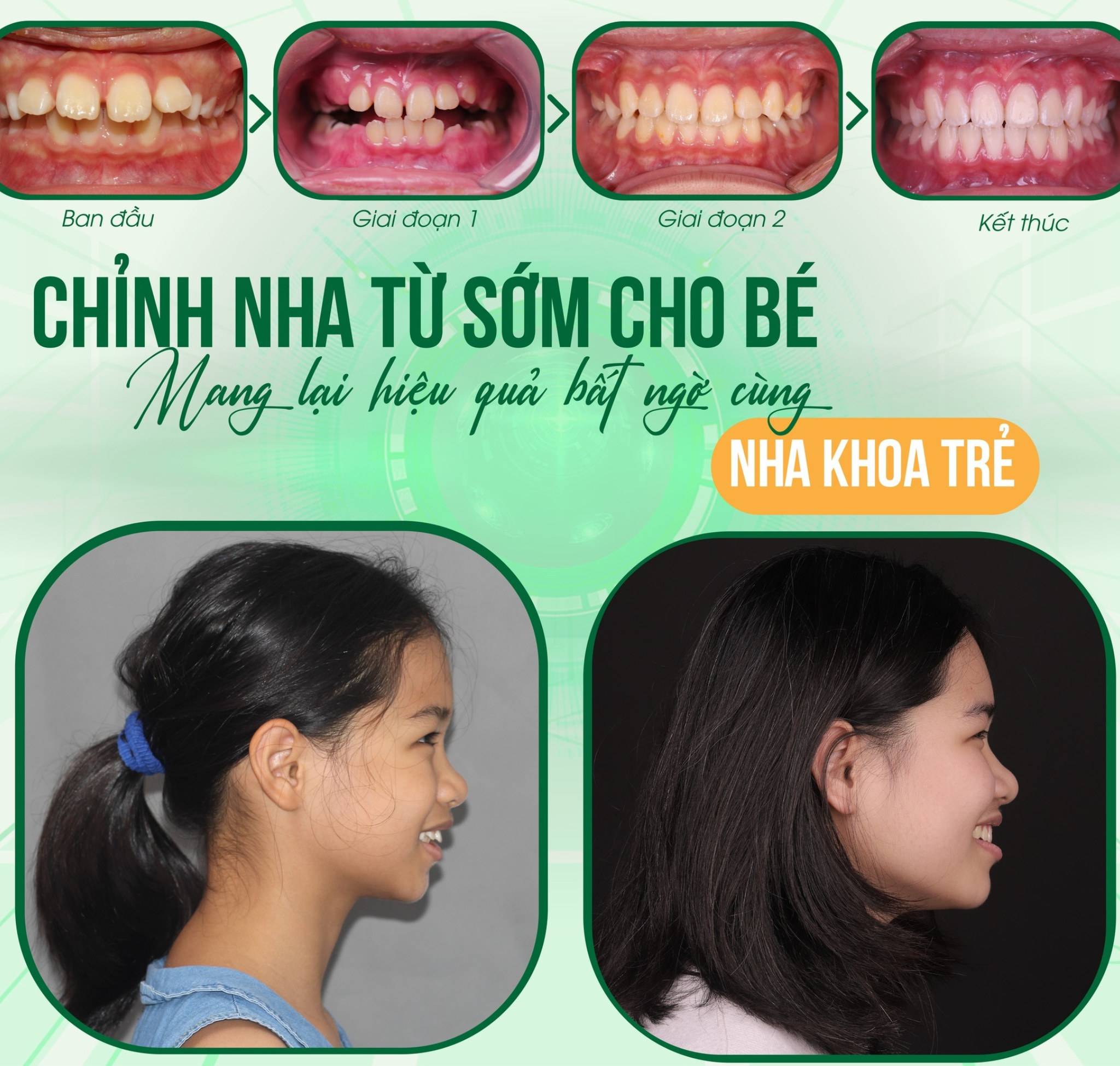 Giai đoạn vàng 7–12 tuổi: ít đau, ít biến chứng